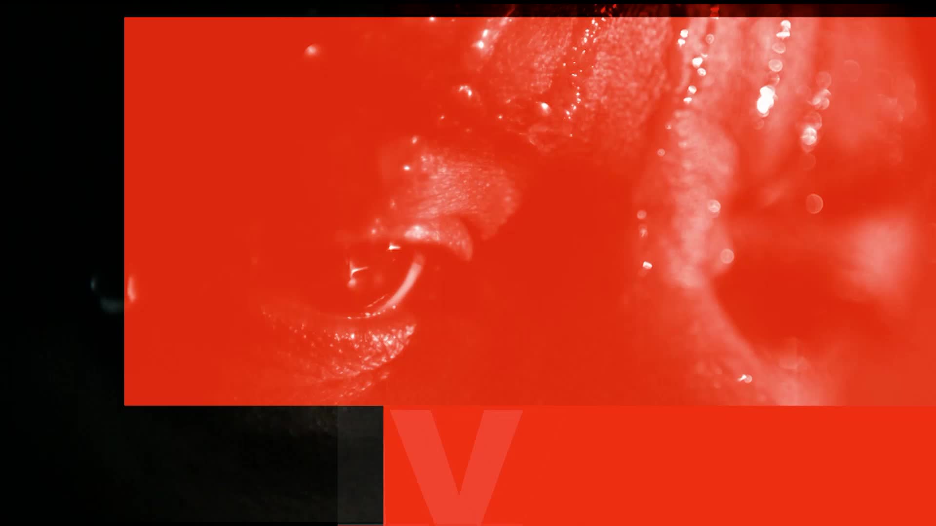 AMCHD