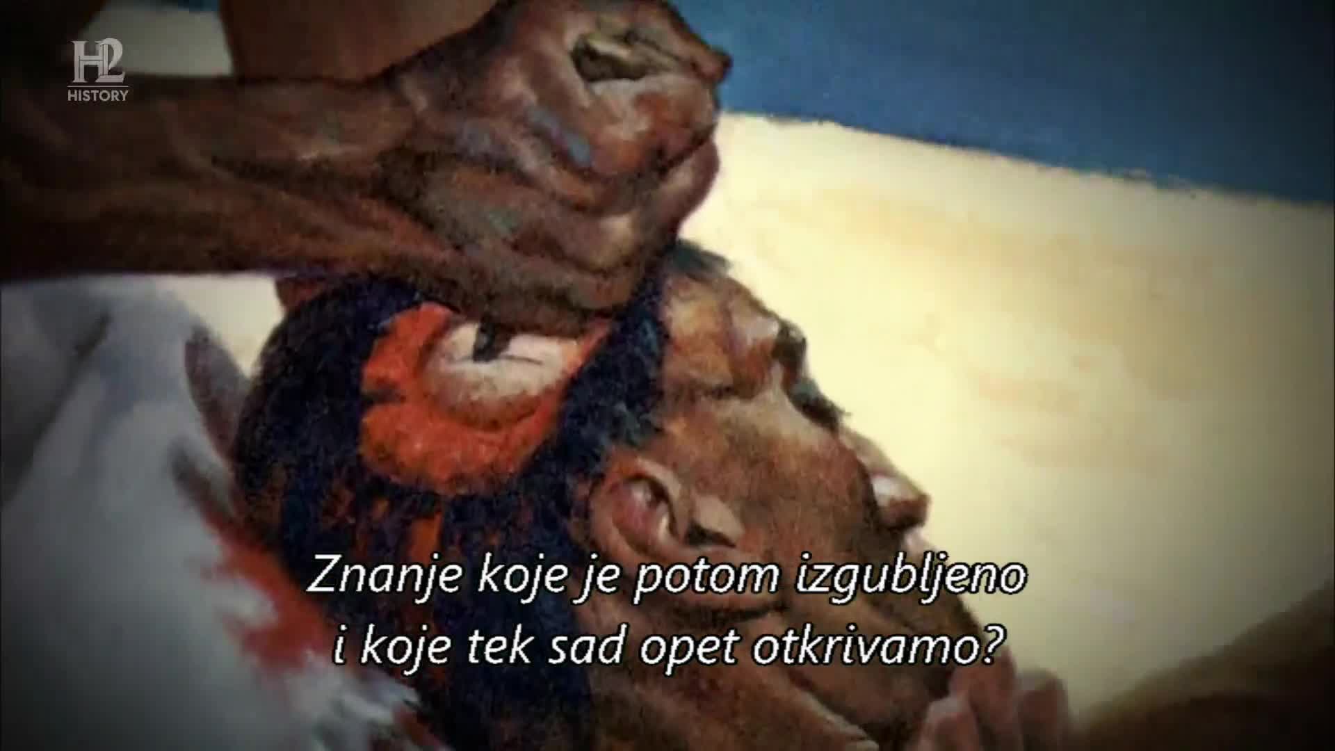 History2