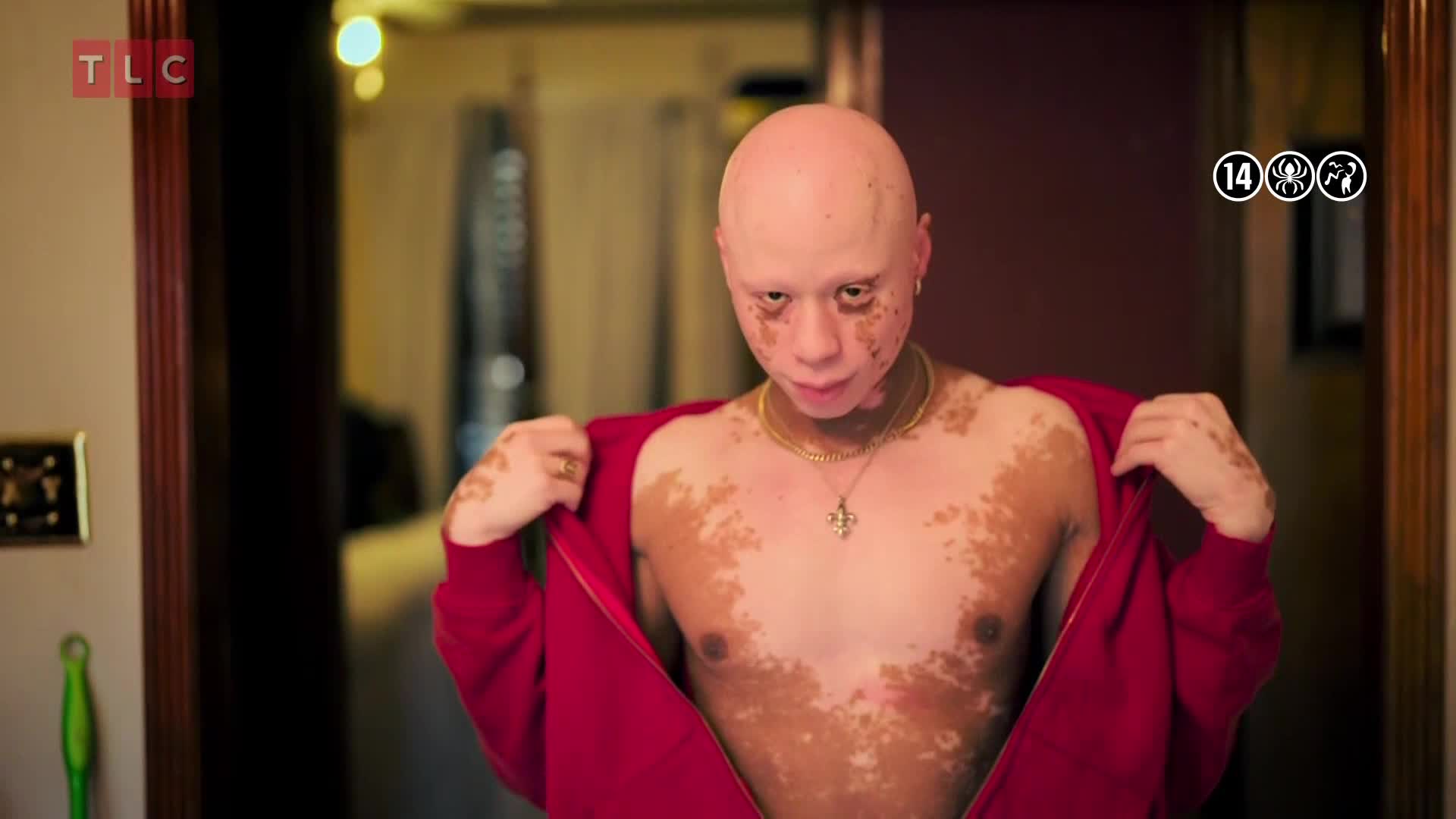 TLC