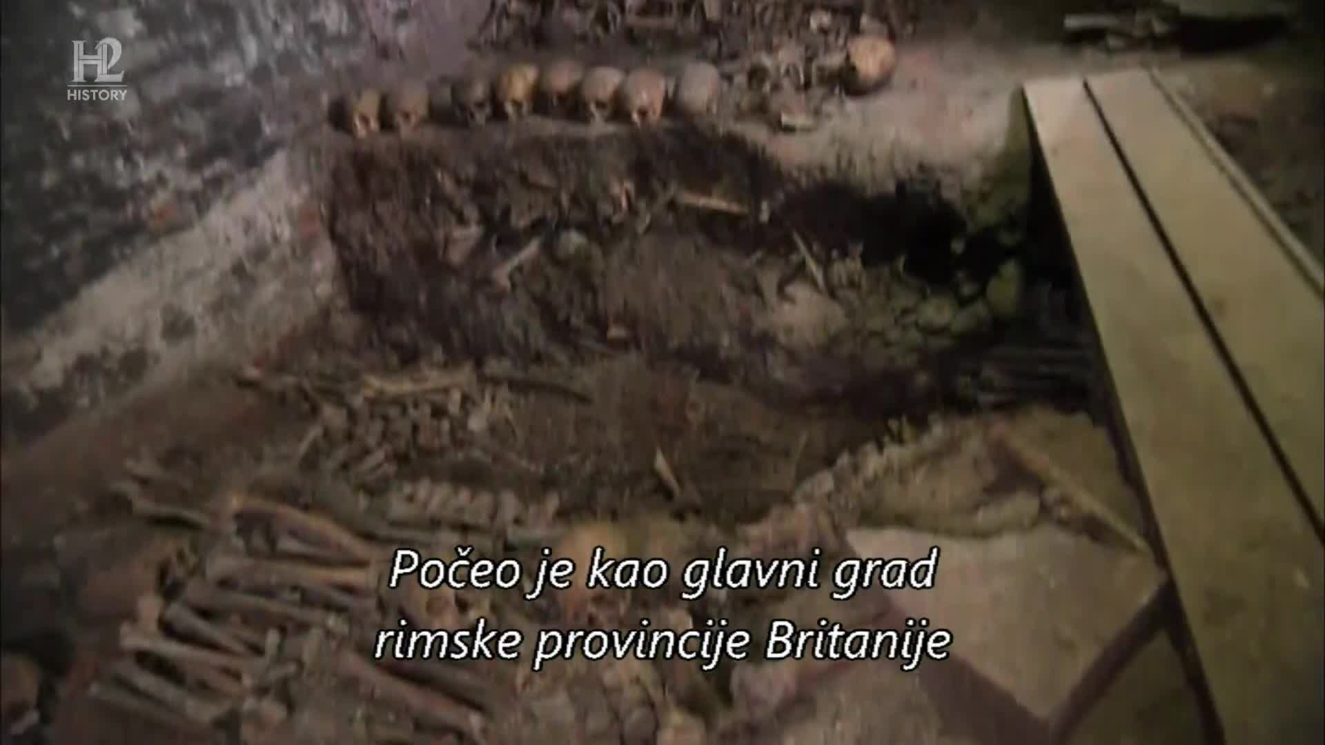 History2