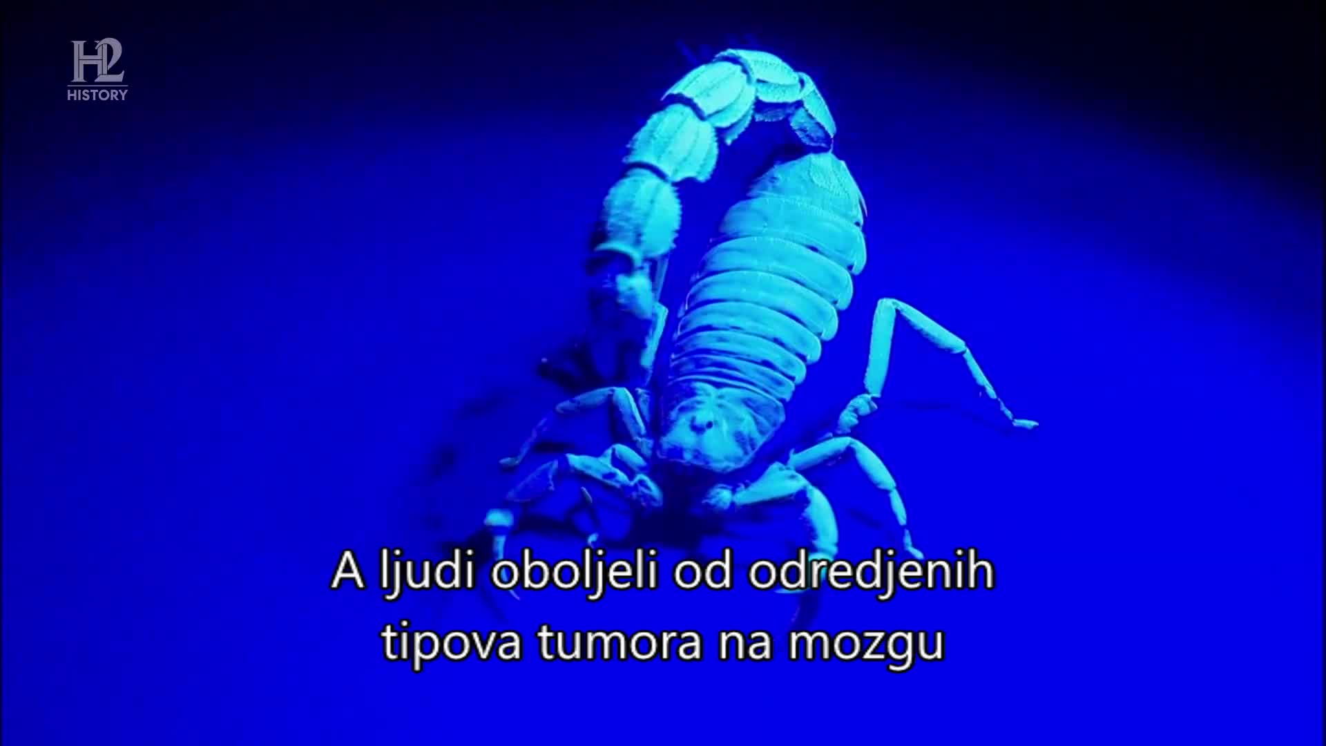 History2